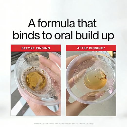 Hismile iD Stain Whitening Mouthwash